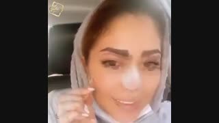 کاشت ابرو طبیعی کلینیک رنسانس