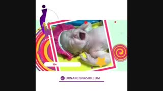 فیلم واقعی زایمان سزارین  هلیا جان