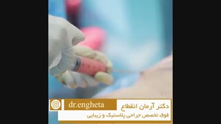 مراقبت های بعد از ترنسفر چربی به باسن تزریق چربی