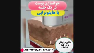 هایفوتراپی اینسایزینگ