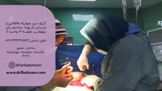 زایمان سزارین