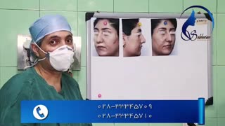 جراحی زیبایی بینی گوشتی با پوست چرب