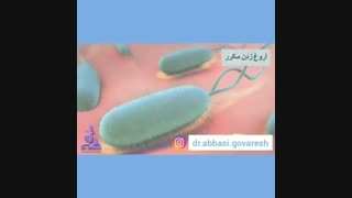 از کجا متوجه میکروب معده بشیم؟