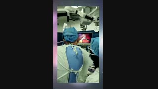 برداشتن کیست کبدی به روش لاپاراسکوپی