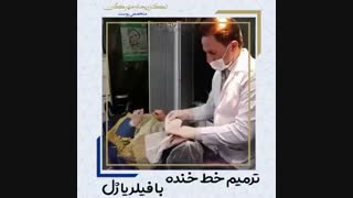 ترمیم خط خنده با تزریق فیلر یا ژل جراحی لثه