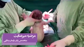 فیلم واقعی زایمان سزارین