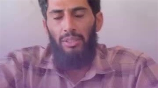 دکتر لیلا صفری جراحی لثه